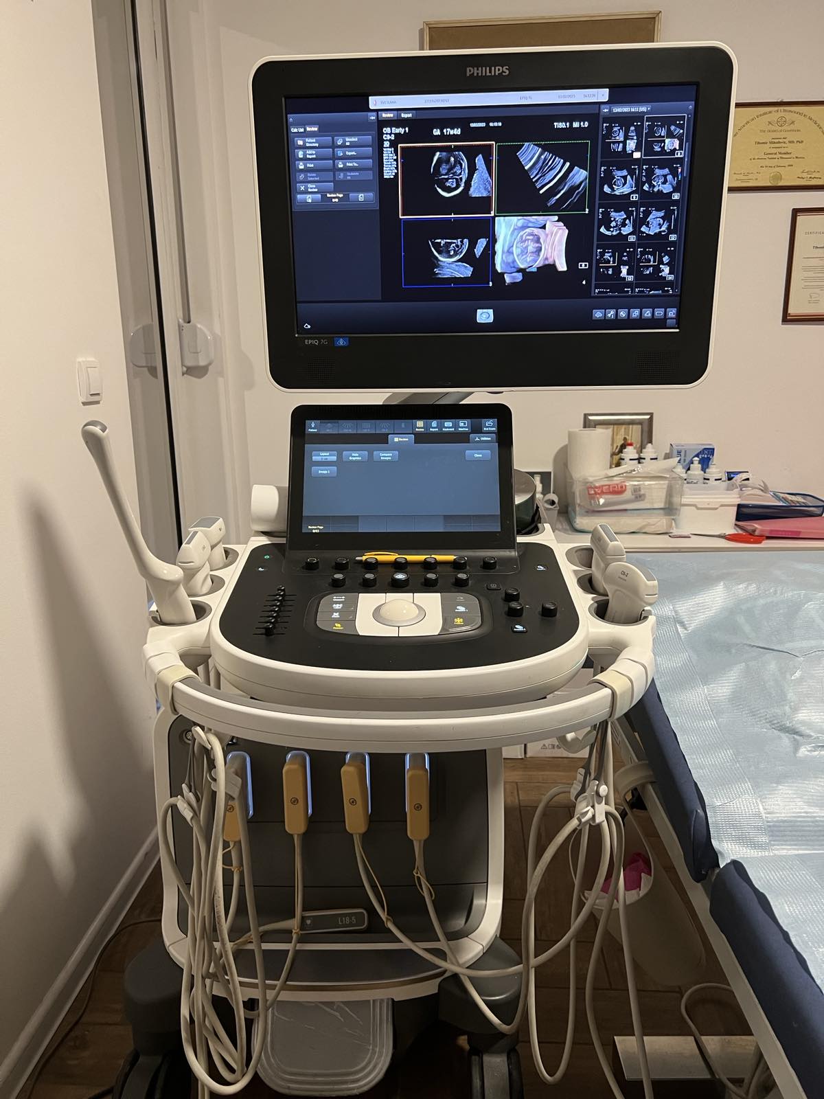 ultrazvucni aparat epiq 7